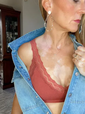 Peek-A-Bra